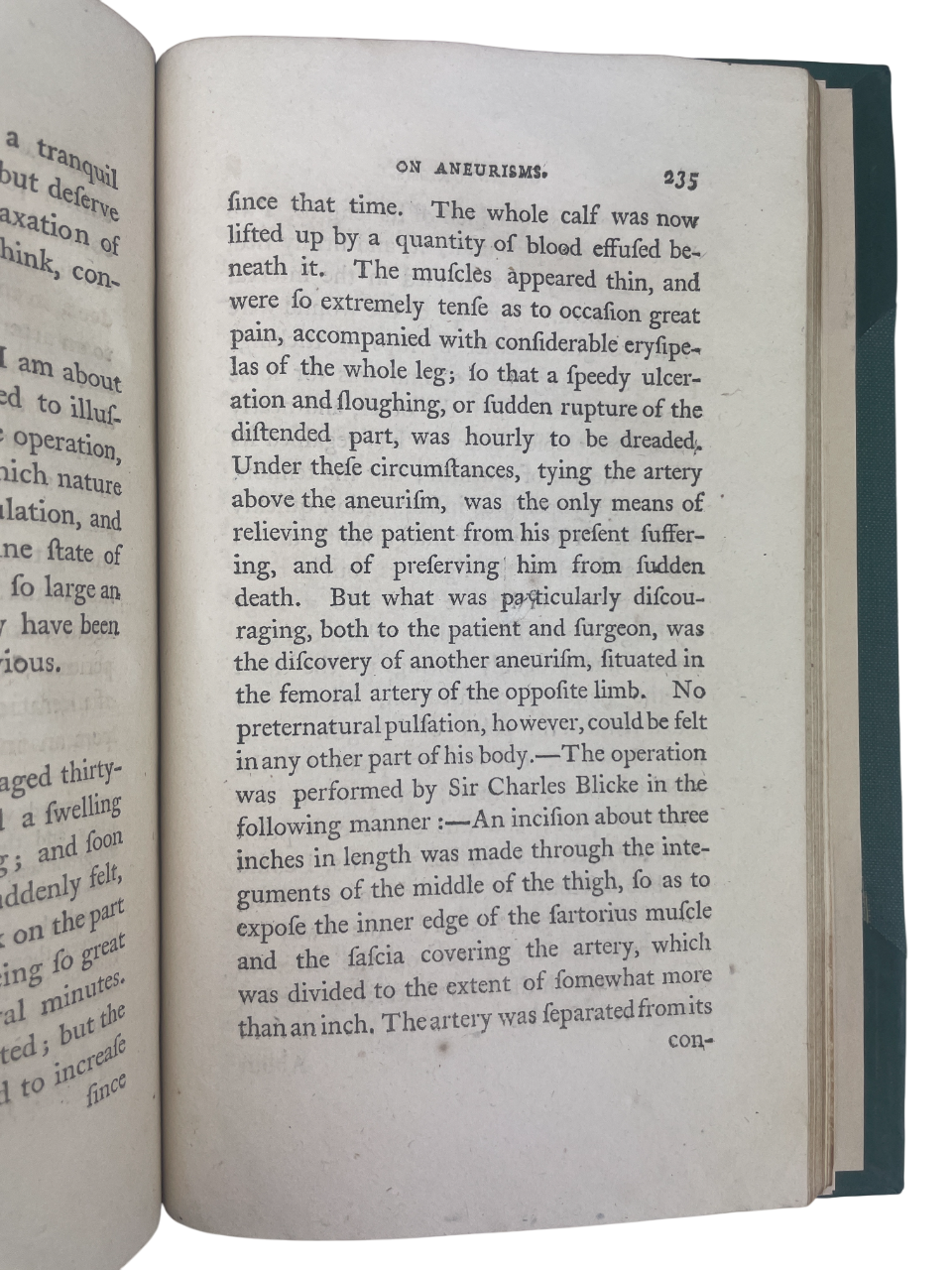 John Abernethy 1809 Surgical Observations rare antique medical book early surgery text arterial ligation aneurism treatment constitutional disease theory St Bartholomew’s Hospital surgeon John Hunter student historic surgical treatise Longman London 19th century medical history collectible original edition influential surgical work rare book dealer UK